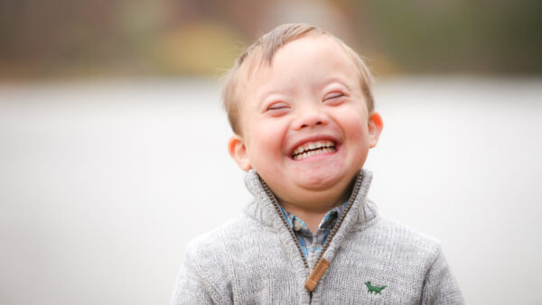 Down Syndrome: Symptoms and Causes